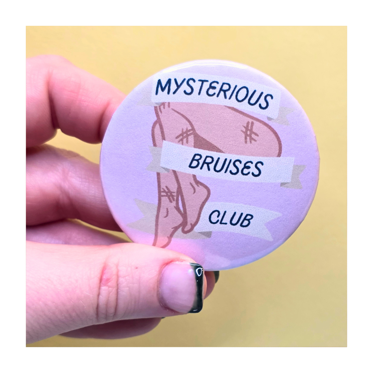 Mysterious Bruises Club Button